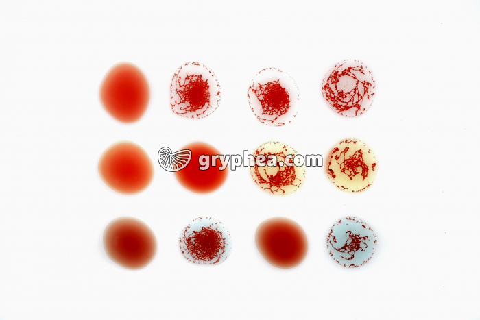 Génétique : les groupes sanguins humains - tests antigéniques - gryphea.org